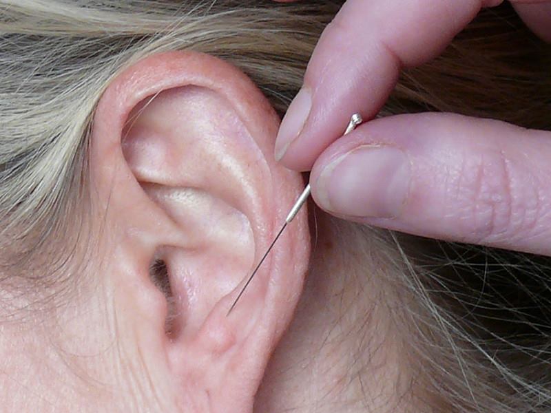 Ohr-Akupunktur für Familien